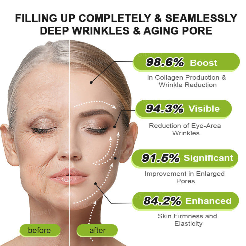 👨‍⚕️Made and shipped from Australia 💫Rolimey® Botox & Vita-A Retinol Shot Wrinkle-Lift Tightening cream - Last Day Promotion 70% OFF